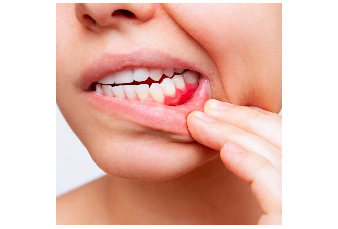 Pack PRESIDENT ACTIVE - Soin complet des gencives sensibles et irritées